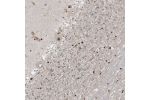 Immunohistochemical staining of human cerebellum shows moderate to strong nuclear positivity in neuronal cells.