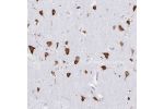 Immunohistochemical staining of human cerebral cortex shows strong cytoplasmic positivity in neuronal cells.