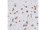 Immunohistochemical staining of human caudate shows strong cytoplasmic positivity in neuronal cells.