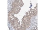 Immunohistochemical staining of human urinary bladder shows weak cytoplasmic positivity in urothelial cells.