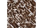 Immunohistochemical staining of human heart muscle shows strong cytoplasmic positivity in cardiomyocytes.