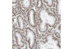 Immunohistochemical staining of human endometrium shows strong nuclear positivity in glandular cells.