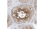 Immunohistochemical staining of human testis shows moderate to strong nuclear and cytoplasmic positivity in cells in seminiferous ducts.