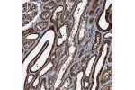 Immunohistochemical staining of human kidney shows strong cytoplasmic positivity in cells in tubules.