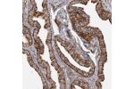 Immunohistochemical staining of human fallopian tube shows strong positivity in glandular cells.
