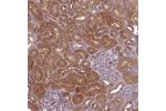 Immunohistochemical staining of human kidney shows strong cytoplasmic positivity in cells in tubules.