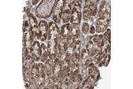 Immunohistochemical staining of human stomach, upper shows strong cytoplasmic positivity in granular pattern in glandular cells.