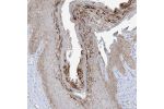 Immunohistochemical staining of human skin shows moderate membranous and cytoplasmic positivity in squamous epithelial cells.