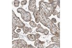 Immunohistochemical staining of human placenta shows moderate cytoplasmic and membranous positivity in trophoblastic cells.