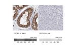 Immunohistochemistry analysis in human testis and liver tissues using HPA035190 antibody. Corresponding GSTM3 RNA-seq data are presented for the same tissues.