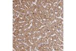 Immunohistochemical staining of human liver shows moderate cytoplasmic positivity in hepatocytes.
