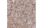 Immunohistochemical staining of human hippocampus shows strong positivity in neuronal processes in neuropil.