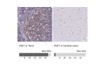 Immunohistochemistry analysis in human tonsil and cerebral cortex tissues using HPA035221 antibody. Corresponding IKZF1 RNA-seq data are presented for the same tissues.