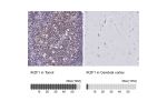 Immunohistochemistry analysis in human tonsil and cerebral cortex tissues using HPA035222 antibody. Corresponding IKZF1 RNA-seq data are presented for the same tissues.