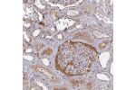 Immunohistochemical staining of human kidney shows weak membranous and cytoplasmic positivity in cells in glomeruli.
