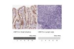 Immunohistochemistry analysis in human small intestine and lymph node tissues using HPA035231 antibody. Corresponding HNF1A RNA-seq data are presented for the same tissues.