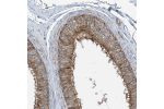 Immunohistochemical staining of human epididymis shows strong cytoplasmic positivity in glandular cells.