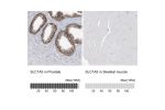 Immunohistochemistry analysis in human prostate and skeletal muscle tissues using HPA035240 antibody. Corresponding SLC1A5 RNA-seq data are presented for the same tissues.