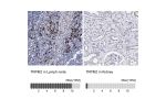 Immunohistochemistry analysis in human lymph node and kidney tissues using Anti-TRPM2 antibody. Corresponding TRPM2 RNA-seq data are presented for the same tissues.