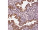 Immunohistochemical staining of human endometrium shows strong cytoplasmic positivity in glandular cells.