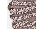 Immunohistochemical staining of human colon shows strong cytoplasmic positivity in glandular cells.