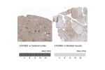 Immunohistochemistry analysis in human cerebral cortex and skeletal muscle tissues using HPA035326 antibody. Corresponding CACNB2 RNA-seq data are presented for the same tissues.