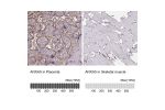 Immunohistochemistry analysis in human placenta and skeletal muscle tissues using HPA035330 antibody. Corresponding ANXA5 RNA-seq data are presented for the same tissues.