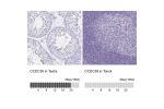 Immunohistochemistry analysis in human testis and tonsil tissues using HPA035364 antibody. Corresponding CCDC39 RNA-seq data are presented for the same tissues.