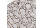 Immunohistochemical staining of human stomach shows moderate to strong nuclear positivity in glandular cells.