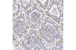 Immunohistochemical staining of human small intestine shows moderate cytoplasmic positivity in glandular cells.
