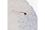 Immunohistochemical staining of human cerebellum shows strong cytoplasmic positivity in Purkinje cells.