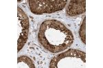 Immunohistochemical staining of human testis shows strong nuclear and cytoplasmic positivity in cells of seminiferus ducts.
