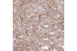 Immunohistochemical staining of human cerebral cortex shows strong cytoplasmic positivity in neuronal cells.