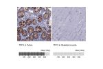 Immunohistochemistry analysis in human colon and skeletal muscle tissues using HPA035464 antibody. Corresponding TFF3 RNA-seq data are presented for the same tissues.