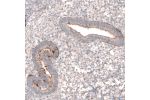 Immunohistochemical staining of human endometrium shows moderate membranous positivity in glandular cells.
