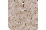 Immunohistochemical staining of human Skeletal muscle shows moderate cytoplasmic positivity in myocytes.
