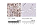 Immunohistochemistry analysis in human placenta and skeletal muscle tissues using HPA035542 antibody. Corresponding KISS1 RNA-seq data are presented for the same tissues.
