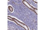 Immunohistochemical staining of human endometrium shows strong nuclear positivity in glandular cells.