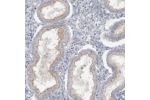 Immunohistochemical staining of human endometrium shows moderate positivity in apical membrane in glandular cells.