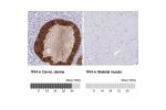 Immunohistochemistry analysis in human cervix, uterine and skeletal muscle tissues using HPA035596 antibody. Corresponding TRH RNA-seq data are presented for the same tissues.