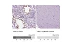 Immunohistochemistry analysis in human testis and skeletal muscle tissues using HPA035689 antibody. Corresponding RFX3 RNA-seq data are presented for the same tissues.