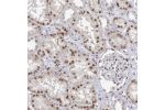Immunohistochemical staining of human kidney shows moderate to strong nuclear positivity in cells in tubules.