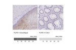 Immunohistochemistry analysis in human esophagus and colon tissues using Anti-KLK8 antibody. Corresponding KLK8 RNA-seq data are presented for the same tissues.