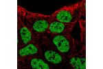 Immunofluorescent staining of human cell line RT4 shows localization to nuclear speckles.