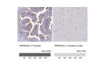 Immunohistochemistry analysis in human prostate and cerebral cortex tissues using HPA035787 antibody. Corresponding TMPRSS2 RNA-seq data are presented for the same tissues.