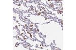 Immunohistochemical staining of human lung shows moderate positivity in macrophages.