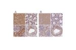 Immunohistochemical staining of human cerebral cortex, colon, kidney and testis using Anti-ADD1 antibody HPA035873 (A) shows similar protein distribution across tissues to independent antibody HPA035874 (B).