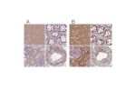 Immunohistochemical staining of human cerebral cortex, colon, kidney and testis using Anti-ADD1 antibody HPA035874 (A) shows similar protein distribution across tissues to independent antibody HPA035873 (B).