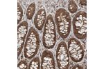 Immunohistochemical staining of human thyroid gland shows moderate cytoplasmic positivity in glandular cells.