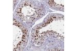 Immunohistochemical staining of human testis shows distinct nuclear positivity in cells in seminiferus ducts.